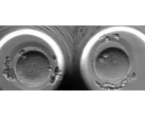 北京代孕最好医院,北京家恩德运试管多少钱，2026年已更新|北京家恩德运