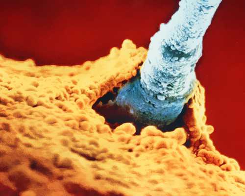 三院第三代试管养囊_世纪高端代怀,泰国试管婴儿周期中为什么要降调-2026年老