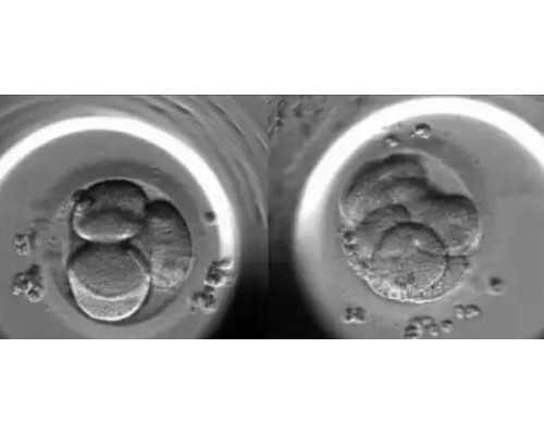 北京正规代孕医院,北京供卵试管机构联系方式,北京供卵试管公司机构