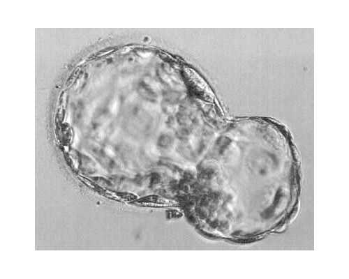 aa69怎么样美国_世纪助孕包成功,做试管婴儿请假一个星期算什么假-青海供卵机