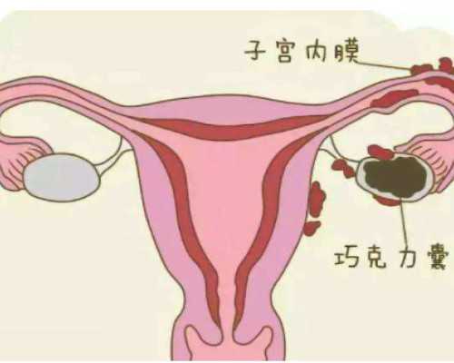 试管婴儿技术助力全球生育健康：孕妈妈与俄罗斯试管婴儿携手共创美好未来