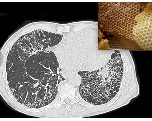 北京助孕价格网,北京三代供卵代孕包男孩靠谱吗
