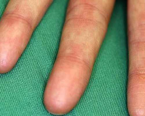 北京去哪里代怀,北京儿童呼吸疾病网络咨询