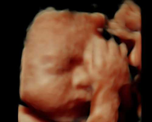 57岁高龄女性是否可以在北京的私立医院进行试管婴儿手术？请推荐2026年北京的