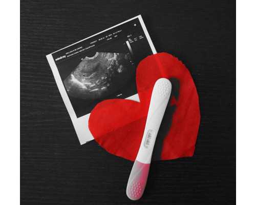 365国际助孕中心_aa69和神州中泰,1988年，我国首位试管婴儿郑萌珠出生，去年又