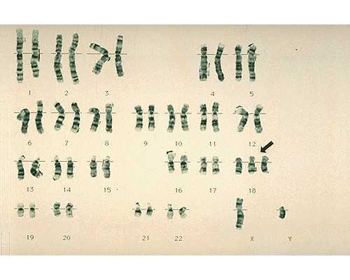 试管婴儿：济南山大医院费用明细及供卵服务详解