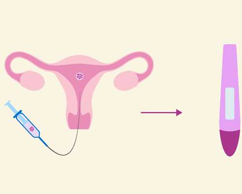 北京哪里供卵最快,北京做试管的医院怎么找