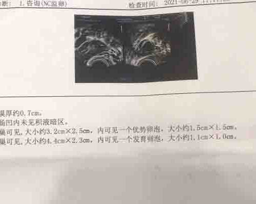 广州三甲医院试管助孕服务认证：短文分享