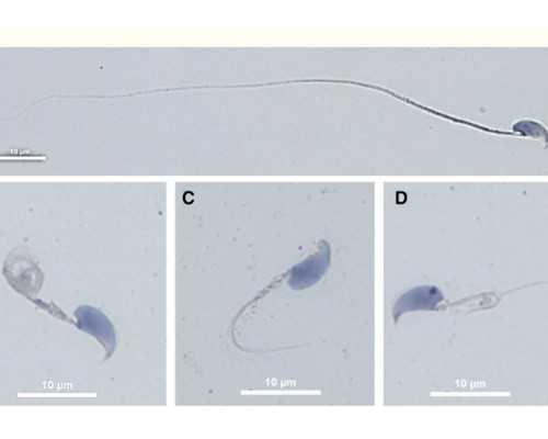 北京做代生费用,北京儿童呼吸疾病网络咨询