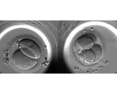 北京供精又供卵费用|北京助孕公司排名-正规试管生子机构