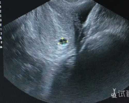 北京靠谱代怀咨询,【焦点】北京供卵试管公司