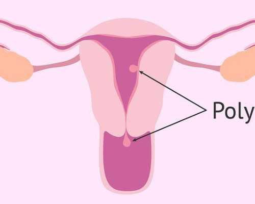 AA69助孕中心_什么叫借卵生子,深圳北大医院做试管婴儿要多少钱？真的贵吗？