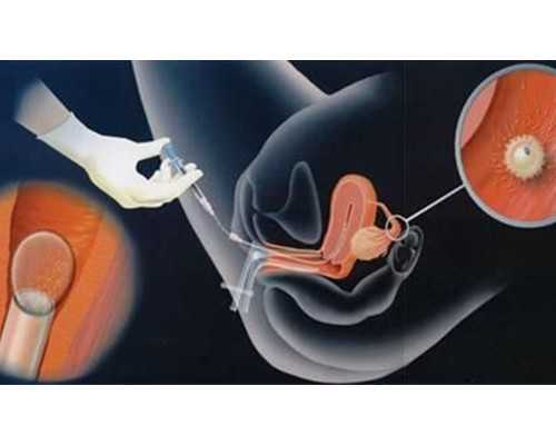 2026
代生_三代试管集爱,2026
北京做试管婴儿哪家医院最好？北京十大试管医院排