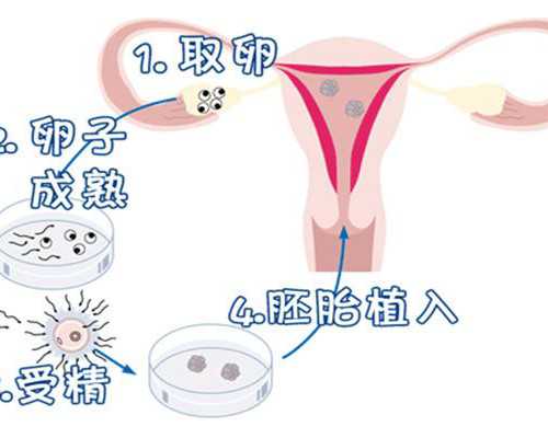 三代试管利弊_2026年洗精代孕,去泰国做试管婴儿中介服务费收多少_人授前医生
