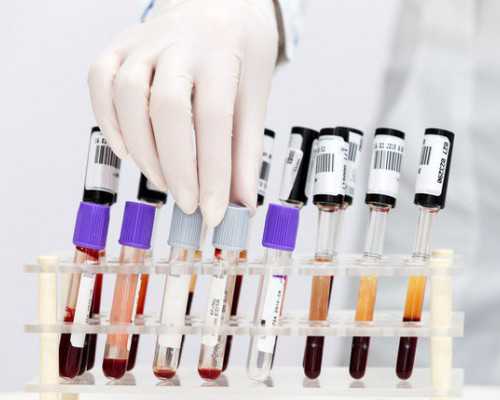 北京医院有代怀吗,北京试管医院排名