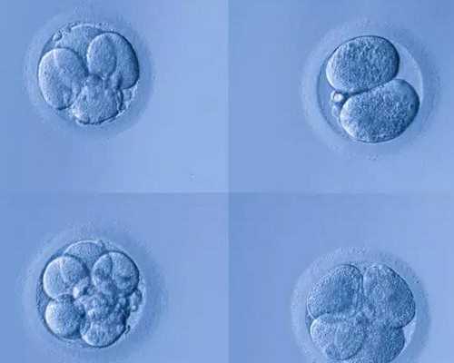 试管婴儿双胞胎减胎是否需要住院?