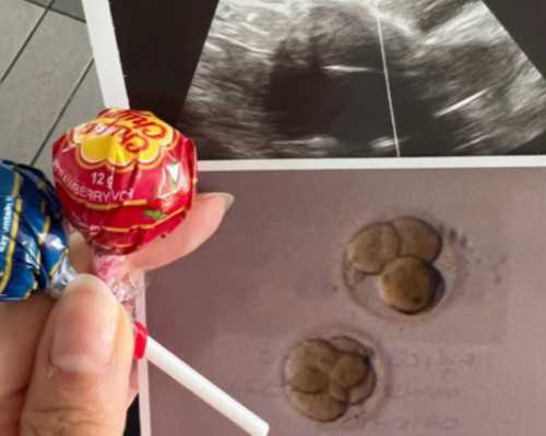 幼儿专注力训练教案(幼儿贪吃蛇游戏教案)