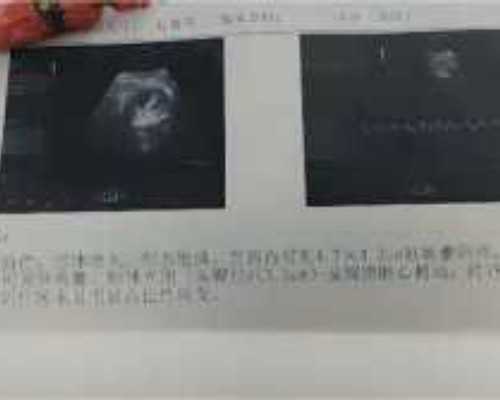 代怀代生_亲贝供卵靠谱吗,试管放2个胚胎的成活率高吗？移植的越多是不是成功