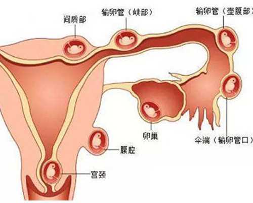 北京做试管婴儿多少钱|宣城三代试管包生男孩价格2026
北京