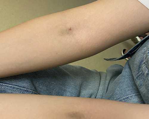 代生生男孩~北京东方医院可以做三代试管吗,技术水平如何?