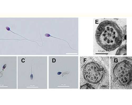 产后妈妈有担忧哺乳期感冒可以喂奶吗