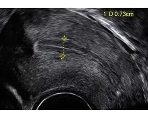 北京权威代孕医院排名,北京三代试管公司，北京试管婴儿怎么做的全过程