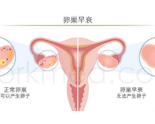 北京助孕助孕妈妈,北京不孕不育在线咨询电话
