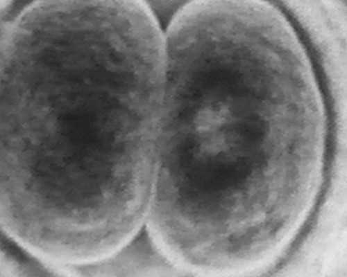 宝妈们怀男孩女孩的症状一样吗？什么方法能知道男孩女孩？