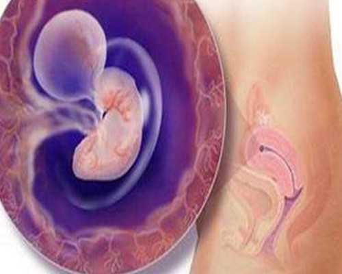 胎停后再次怀孕还会胎停吗